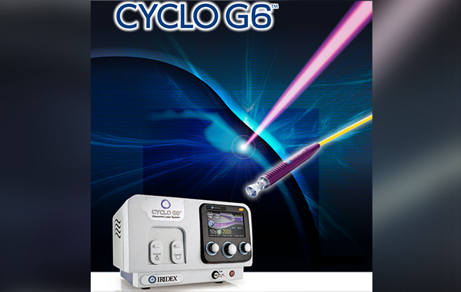 イメージ：新しい緑内障レーザー治療CYCLO G6
