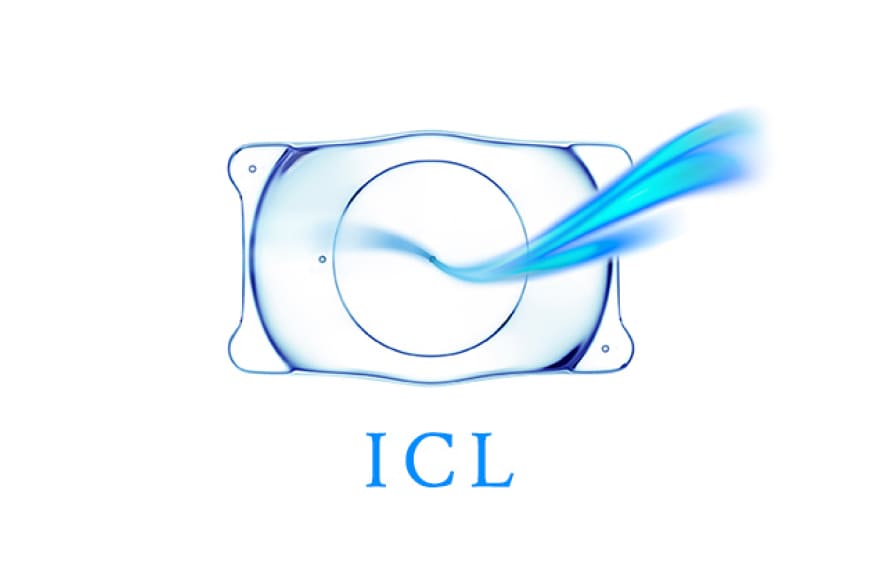 イメージ：眼内コンタクトレンズ（ICL）